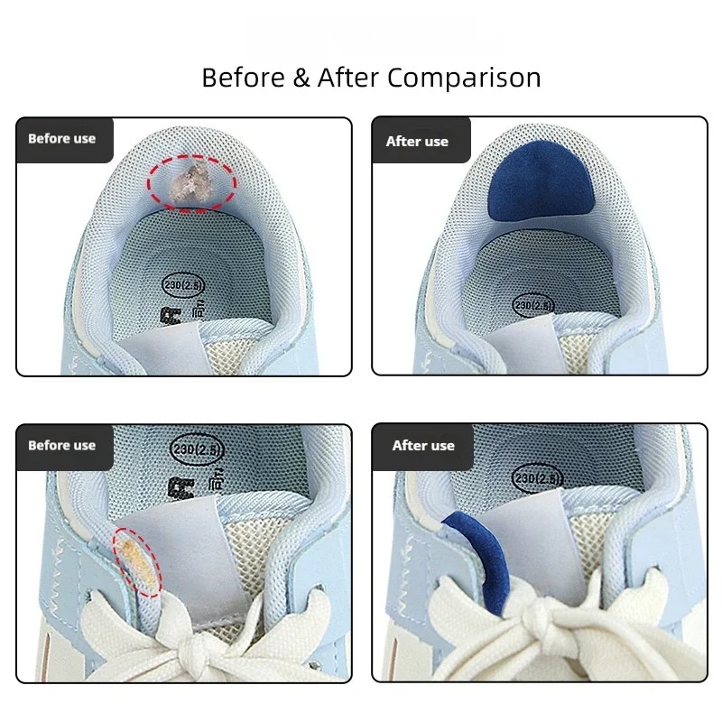 Набор из 6 наклеек-протекторов – обзор и цена Sneaker Care Service